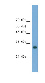 FAM78A antibody LS-C117132 Western blot of Transfected 293T cell lysate.