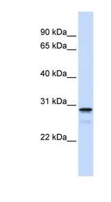 FAM78B antibody LS-C102404 Western blot of 721_B cell lysate.