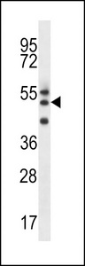 RMD2 Antibody western blot of uterus tumor cell line lysates (35 ug/lane). The RMD2 antibody detected the RMD2 protein (arrow).