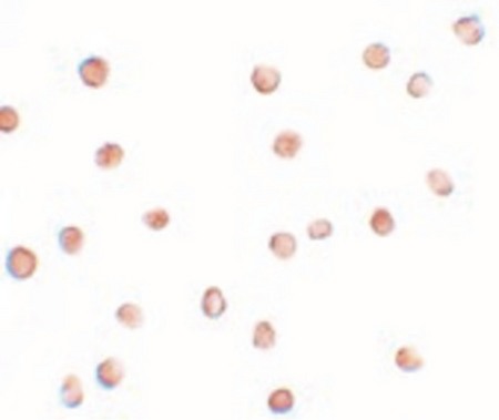 Immunocytochemistry of ENC-2 in Jurkat cells with ENC-2 antibody at 5 ug/ml.
