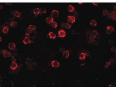 Immunofluorescence of FAM82A1 in K562 cells with FAM82A1 antibody at 20 ug/ml.