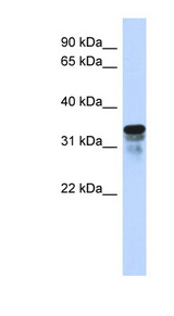FAM82B antibody LS-C102212 Western blot of Transfected 293T cell lysate.