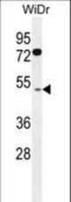 RMD1 Antibody western blot of WiDr cell line lysates (35 ug/lane). The RMD1 antibody detected the RMD1 protein (arrow).