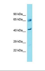 Western blot of Fetal Liver. FAM83A antibody dilution 1.0 ug/ml.