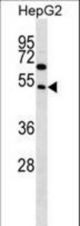 FAM83A Antibody (D283) western blot of HepG2 cell line lysates (35 ug/lane). The FAM83A antibody detected the FAM83A protein (arrow).