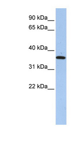 FAM84A antibody LS-C102474 Western blot of HepG2 cell lysate.