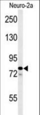 Western blot of F91A1 Antibody in Neuro-2a cell line lysates (35 ug/lane). F91A1 (arrow) was detected using the purified antibody.