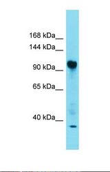 Western blot of Fetal Heart. FAM91A1 antibody dilution 1.0 ug/ml.