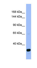 FANCA antibody LS-C107628 Western blot of Fetal Spleen lysate.