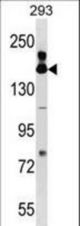 FANCA Antibody western blot of 293 cell line lysates (35 ug/lane). The FANCA antibody detected the FANCA protein (arrow).