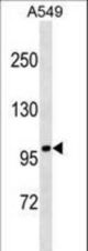 FANCB Antibody western blot of A549 cell line lysates (35 ug/lane). The FANCB antibody detected the FANCB protein (arrow).