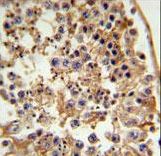 FANCC Antibody IHC of formalin-fixed and paraffin-embedded testis tissue followed by peroxidase-conjugated secondary antibody and DAB staining.