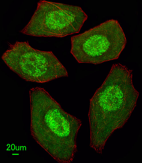 Immunofluorescent of U251 cells, using FANCC Antibody. Antibody was diluted at 1:25 dilution. Alexa Fluor 488-conjugated goat anti-rabbit lgG at 1:400 dilution was used as the secondary antibody (green). DAPI was used to stain the cell nuclear (blue).