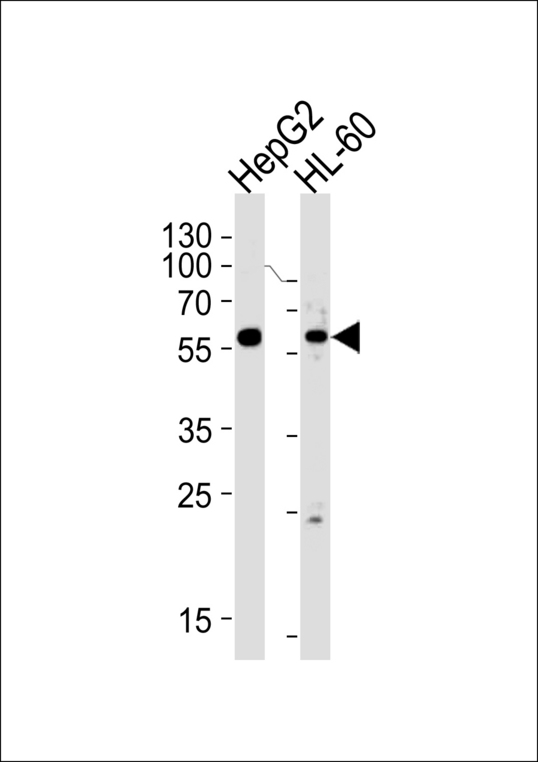 Western blot of lysates from HepG2,HL-60 cell line (from left to right),using FANCC Antibody. Antibody was diluted at 1:1000 at each lane. A goat anti-rabbit IgG H&L (HRP) at 1:5000 dilution was used as the secondary antibody.Lysates at 35ug per lane.