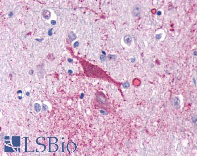 Anti-CNR1 / CB1 antibody LS-A32 IHC of human brain, neuron. Immunohistochemistry of formalin-fixed, paraffin-embedded tissue after heat-induced antigen retrieval.