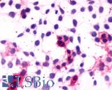 Anti-CNR1 / CB1 antibody LS-A32 immunocytochemistry (ICC) staining of HEK293 human embryonic kidney cells transfected with CNR1 / CB1.