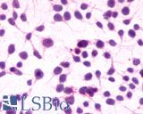 Anti-CNR1 / CB1 antibody LS-A32 immunocytochemistry (ICC) staining of untransfected HEK293 human embryonic kidney cells.