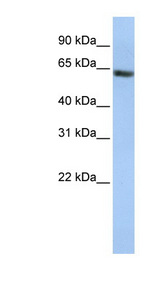 FANCE antibody LS-C102625 Western blot of HepG2 cell lysate.