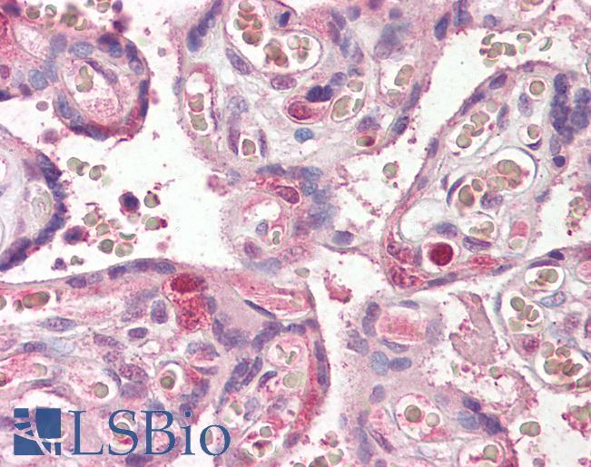 Anti-FANCE antibody IHC of human placenta. Immunohistochemistry of formalin-fixed, paraffin-embedded tissue after heat-induced antigen retrieval. Antibody LS-B7400 concentration 3.75 ug/ml.