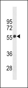 CB1 Antibody western blot of 293 cell line lysates (35 ug/lane). The CB1 antibody detected the CB1 protein (arrow).