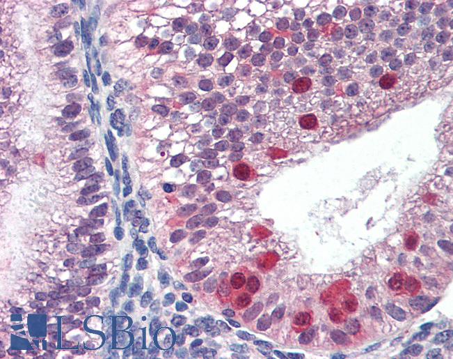 Anti-FANCG antibody IHC of human uterus. Immunohistochemistry of formalin-fixed, paraffin-embedded tissue after heat-induced antigen retrieval. Antibody LS-B2997 concentration 3 ug/ml.