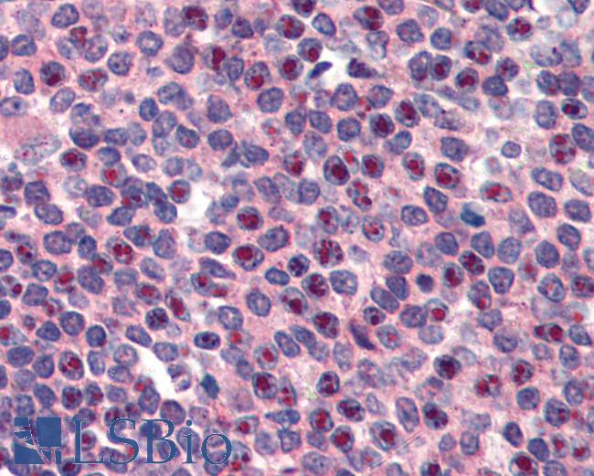 Anti-FANCG antibody IHC of human spleen. Immunohistochemistry of formalin-fixed, paraffin-embedded tissue after heat-induced antigen retrieval. Antibody LS-B2997 concentration 3 ug/ml.