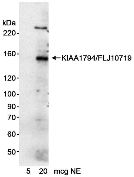 Detection of Human KIAA1794/FLJ10719 by Western Blot. Samples: Nuclear extract (5 and 20 ug) from HeLa cells. Antibody: Affinity purified rabbit anti-KIAA1794/FLJ10719 antibody used at 0.2 ug/ml. Detection: Chemiluminescence with an exposure time of 15 minutes.