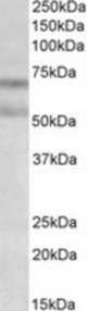 CNR1 antibody (0.3 ug/ml) staining of Rat Brain lysate (35 ug protein/ml in RIPA buffer). Primary incubation was 1 hour. Detected by chemiluminescence.