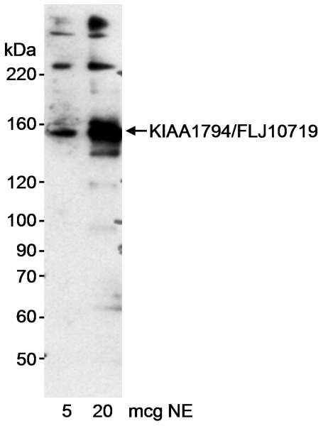 Detection of Human KIAA1794/FLJ10719 by Western Blot. Samples: Nuclear extract (5 and 20 ug) from HeLa cells. Antibody: Affinity purified rabbit anti-KIAA1794/FLJ10719 antibody used at 0.2 ug/ml. Detection: Chemiluminescence with an exposure time of 15 minutes.