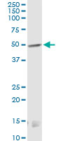 CNR1 monoclonal antibody (M01), clone 2F9. Western Blot analysis of CNR1 expression in rat testis.