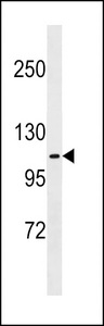 FARP1 Antibody western blot of A375 cell line lysates (35 ug/lane). The FARP1 antibody detected the FARP1 protein (arrow).
