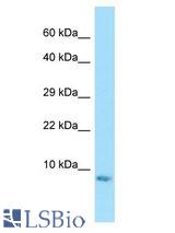 FARP1 / CDEP antibody Western Blot of Rat Stomach. Antibody dilution: 1 ug/ml.