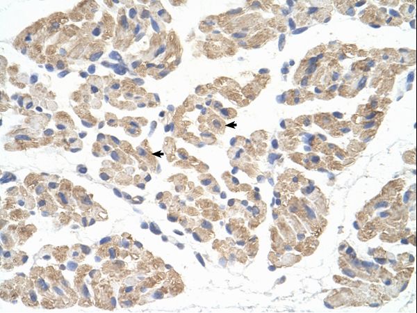 FARS2 antibody LS-C40318 was used in IHC to stain formalin-fixed, paraffin-embedded human muscle.