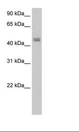 Transfected 293T Cell Lysate