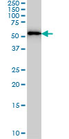 FARSLA monoclonal antibody (M01), clone 2D8 Western Blot analysis of FARSLA expression in MCF-7.
