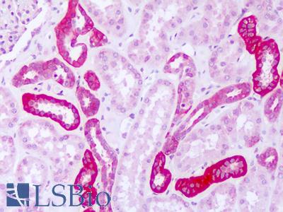 Anti-FARSA antibody IHC of human kidney. Immunohistochemistry of formalin-fixed, paraffin-embedded tissue after heat-induced antigen retrieval. Antibody LS-B8277 dilution 5-10 ug/ml.