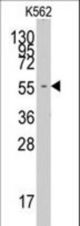 Western blot of anti-FARSA antibody in K562 cell line lysates (35 ug/lane). FARSA (arrow) was detected using the purified antibody.
