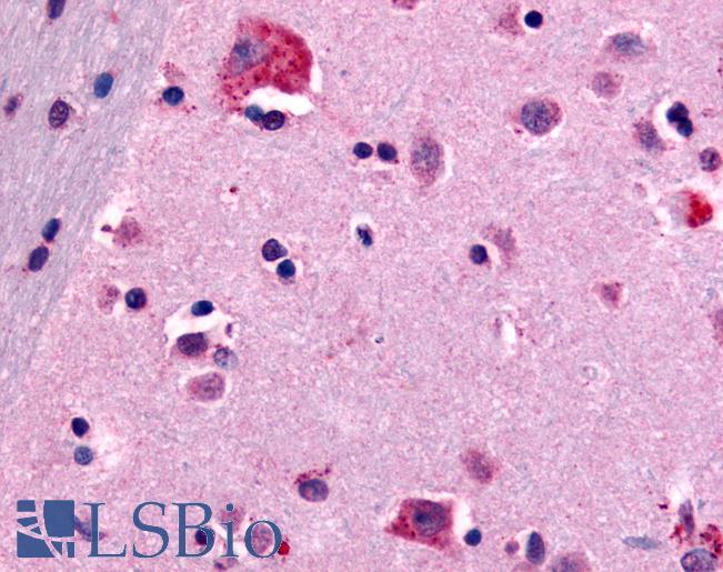 Anti-CNR1 / CB1 antibody LS-A4039 IHC of human brain, neurons and glia. Immunohistochemistry of formalin-fixed, paraffin-embedded tissue after heat-induced antigen retrieval.