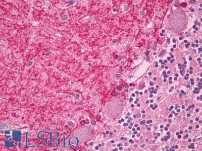 Human, Brain Cerebellum: Formalin-Fixed Paraffin-Embedded (FFPE)