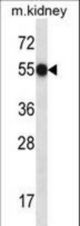 Mouse Fastk Antibody western blot of mouse kidney tissue lysates (35 ug/lane). The Fastk antibody detected the Fastk protein (arrow).