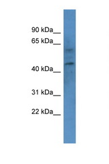 CNR1 / CB1 antibody LS-B8253 Western blot of COL0205 Cell lysate. Antibody concentration 1 ug/ml.