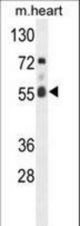 Western blot of hFASTK-R534 in mouse heart tissue lysates (35 ug/lane). FASTK (arrow) was detected using the purified antibody.