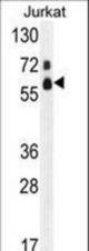 Western blot of hFASTK-R534 in Jurkat cell line lysates (35 ug/lane). FASTK (arrow) was detected using the purified antibody.