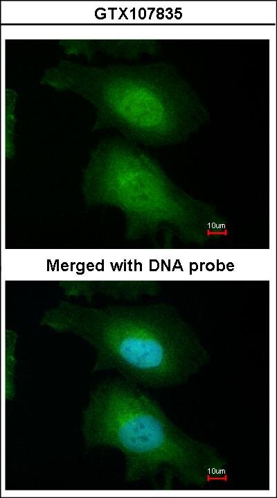 Immunofluorescence of paraformaldehyde-fixed HeLa using FASTKD1 antibody at 1:200 dilution.