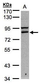 Sample. A:30g of Hep G2 whole cell lysate . 7.5% SDS PAGE. FASTKD1 antibody diluted at 1:1000