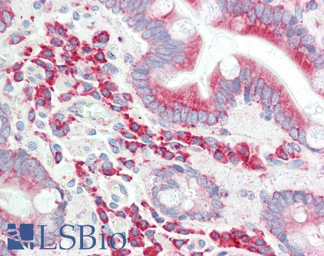 Anti-FASTKD1 antibody IHC staining of human small intestine. Immunohistochemistry of formalin-fixed, paraffin-embedded tissue after heat-induced antigen retrieval. Antibody LS-B9962 concentration 10 ug/ml.