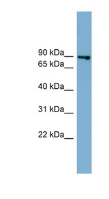 FASTKD2 antibody LS-C111606 Western blot of 721_B cell lysate.