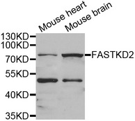 Western blot analysis of extracts of various cell lines, using FASTKD2 antibody.
