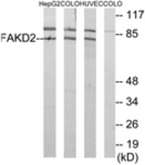 Western blot of extracts from HUVEC/HepG2/COLO cells, using FAKD2 Antibody. The lane on the right is treated with the synthesized peptide.