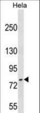 FASTKD3 Antibody western blot of HeLa cell line lysates (35 ug/lane). The FASTKD3 antibody detected the FASTKD3 protein (arrow).